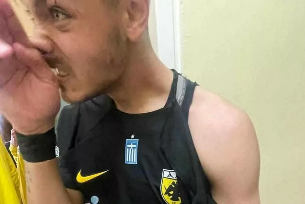 Ξύλο στα αποδυτήρια μετά το Κοζάνη – ΑΕΚ Β’, με σκισμένη φανέλα και ανοιγμένη μύτη ο Χριστόπουλος